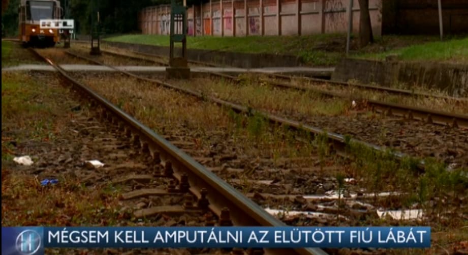 Mégsem kell amputálni a 61-es villamos által elütött fiú lábát