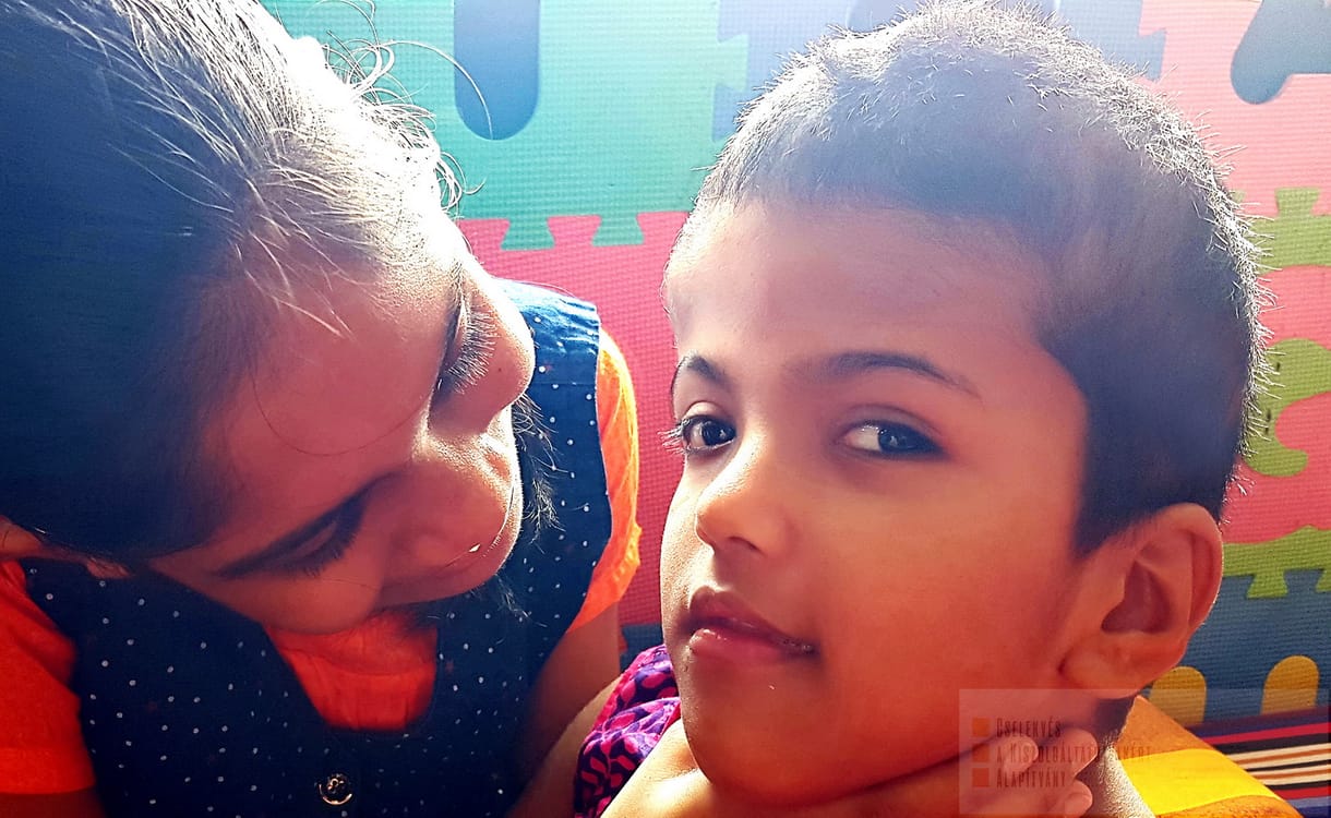 Újabb, sikeres nagyműtéten vannak túl a bangladesi sziámi ikreket szétválasztó orvosok