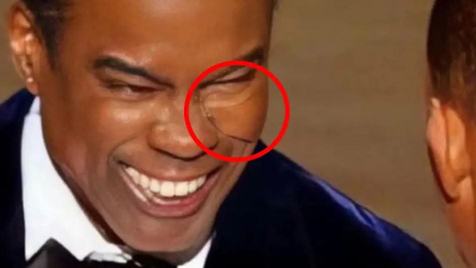 Kamu a neten terjedő kép, Chris Rock nem viselt arcvédőt, amikor Will Smith megpofozta