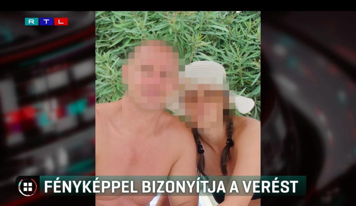 Véraláfutásos fotóval bizonyítja a kisfiút felrúgó karateedző volt barátnője, hogy a férfi verte