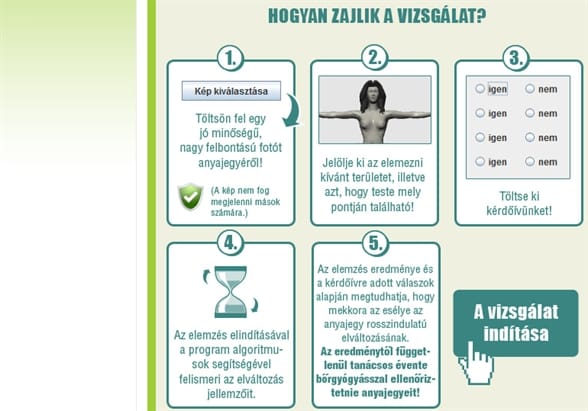 Gyanús az egyik anyajegye? Itt az online melanomaszűrés 