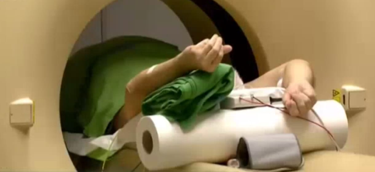 Balog mondott egy erőset a hiányzó CT-kről