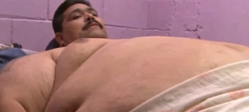 Megműtik a világ legsúlyosabb, 435 kilogrammos férfiját