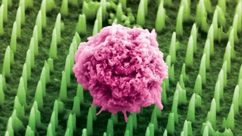 20 perc alatt eredményt ad, fájdalommentessé teszi a biopsziát az új orvosi csodatapasz