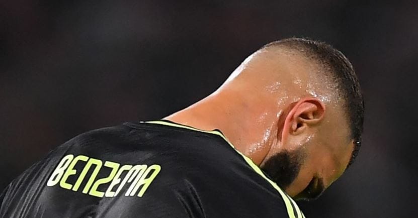 Októberig kidőlt Benzema