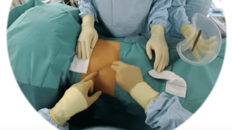 Így tanítják az orvosokat: napszemüveggel készült élő videón követték a műtétet