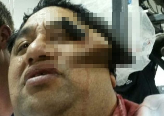 Pert nyert a horrorsérülést szenvedett húsüzemi dolgozó – 18+ videó