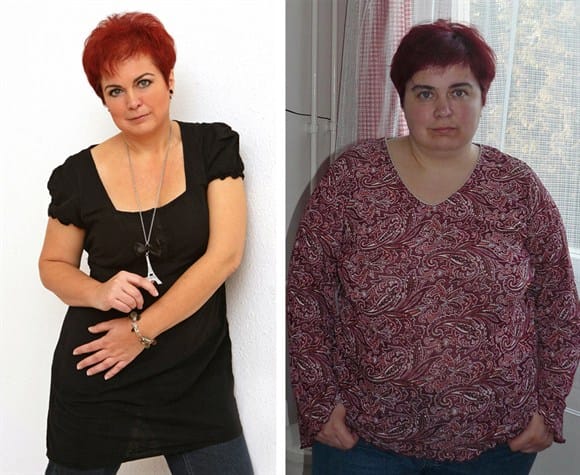 Fotó: 46 kilót fogyott egy zalaegerszegi nő