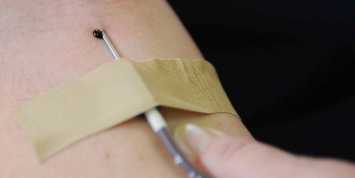 Most először adtak embereknek mesterségesen előállított vért