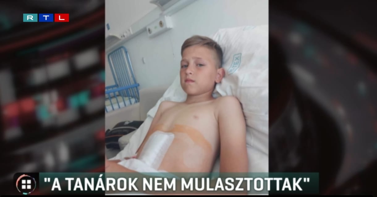 Úgy megrúgdosták 10 éves osztálytársukat, hogy életmentő műtétre volt szükség, az iskola mossa kezeit