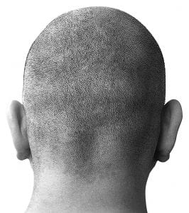 Seres: Abszurdisztán skinheadjei
