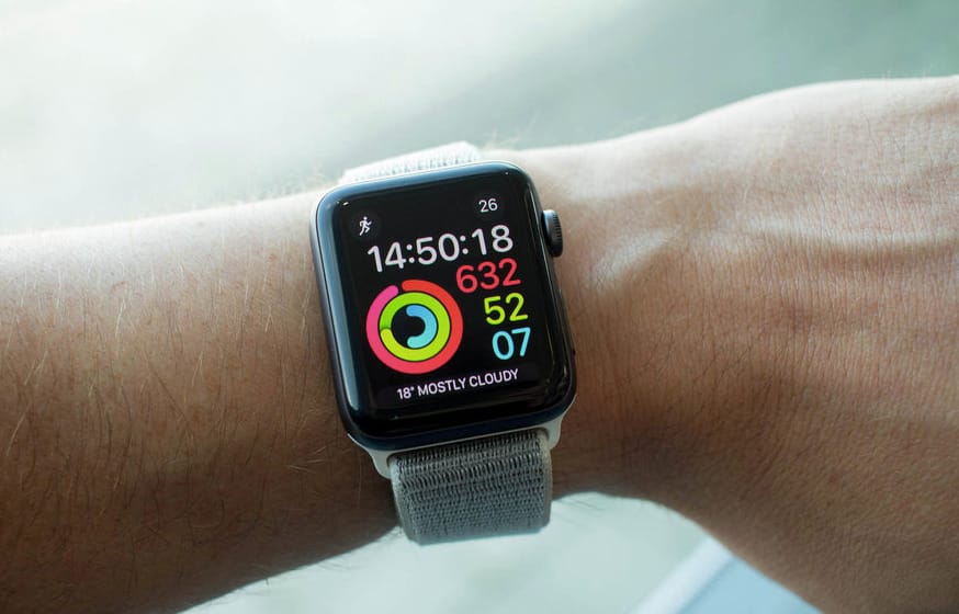 Autóbalesetet szenvedett a férfi, az Apple Watch-on keresztül hívott segítséget