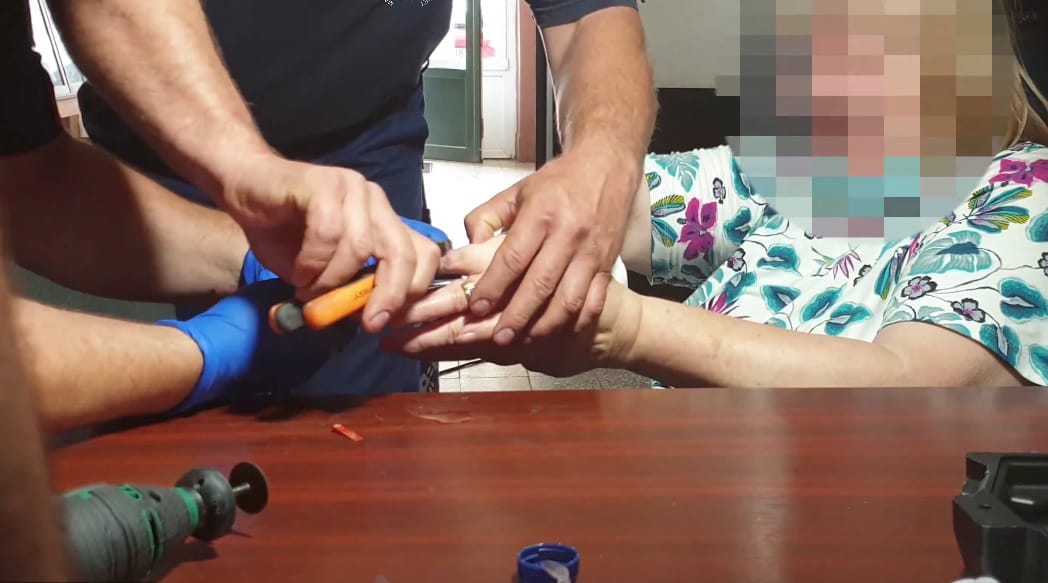 Körfűrésszel „operálták le” a tűzoltók egy nő ujjáról a rászorult gyűrűt
