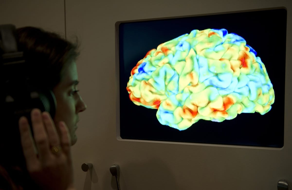 Egy MRI-vizsgálattal tűpontosan kimutatható, ki liberális, ki konzervatív