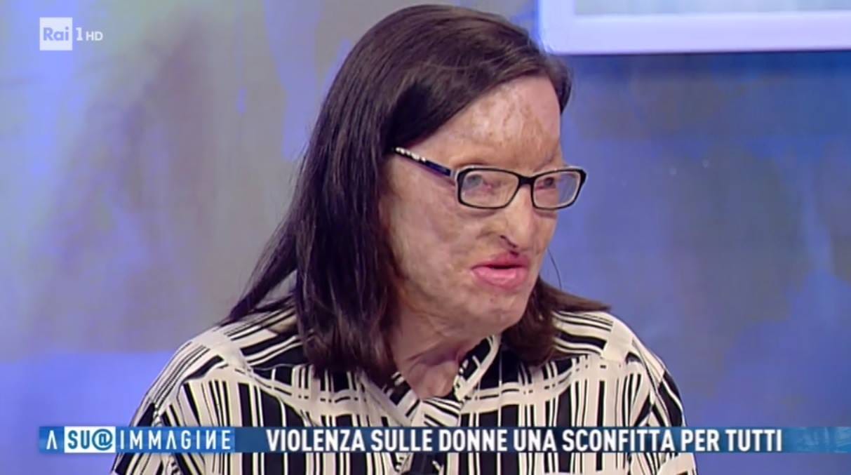 Savval bántalmazott nőnek írt levelet Ferenc pápa