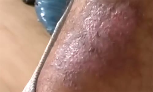 Videó: a 11 éves lányom megégett, hogyan kárpótolhatnának?