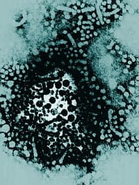 Budapesten él a legtöbb hepatitis C-s intravénás drogos