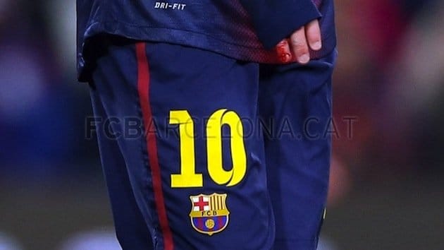 Fotó: véresre taposták Messi kezét hétvégén