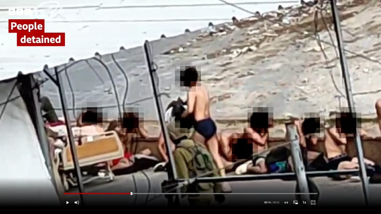 Videót közölt a BBC egy palesztin orvosról, aki azt állítja, hogy izraeli katonák törték el a kezét