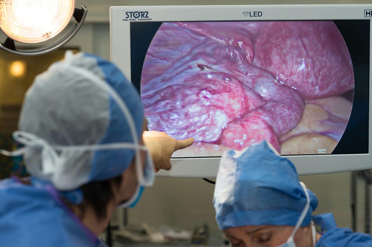 Nők milliói számára fontos: mivel jár még az endometriózis?