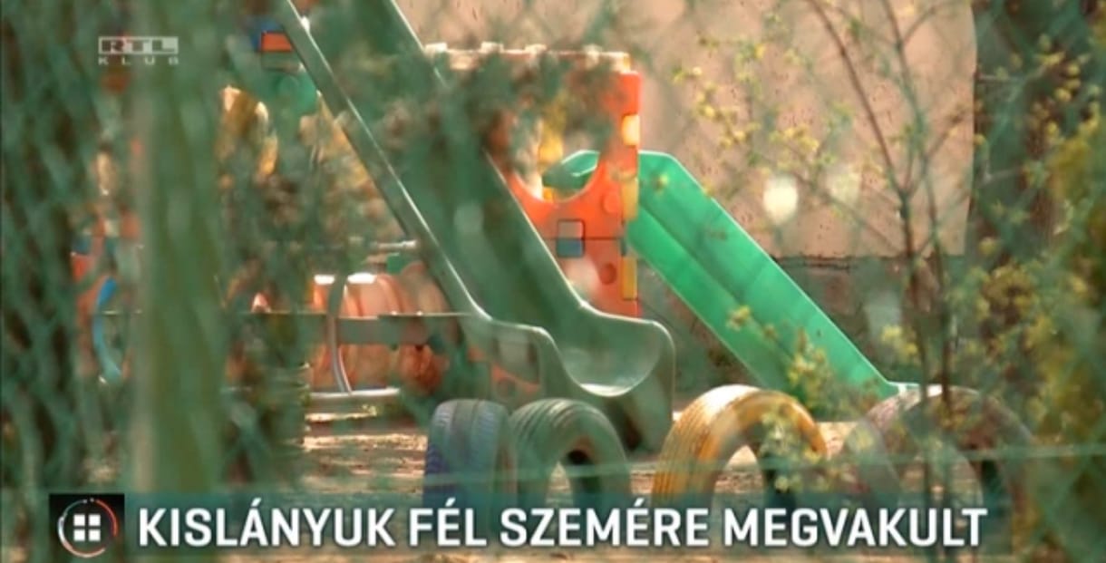 Annyira elhanyagolták a hevesi kislányt a szülei, hogy fél szemére megvakult
