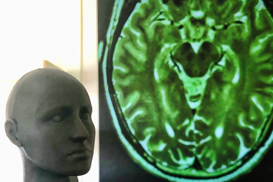 Meglepetést hozott, amikor fMRI géppel vizsgálták a vakok agyát