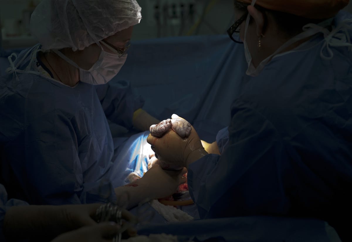 Halogatták az abortuszát, császármetszést kellett végezni egy 11 éves kislányon