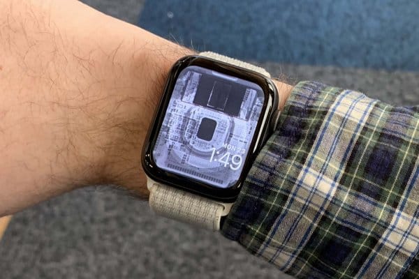 Olyan menő röntgenképek jöttek az Apple Watchokhoz, amilyeneket nem gyakran látni órán