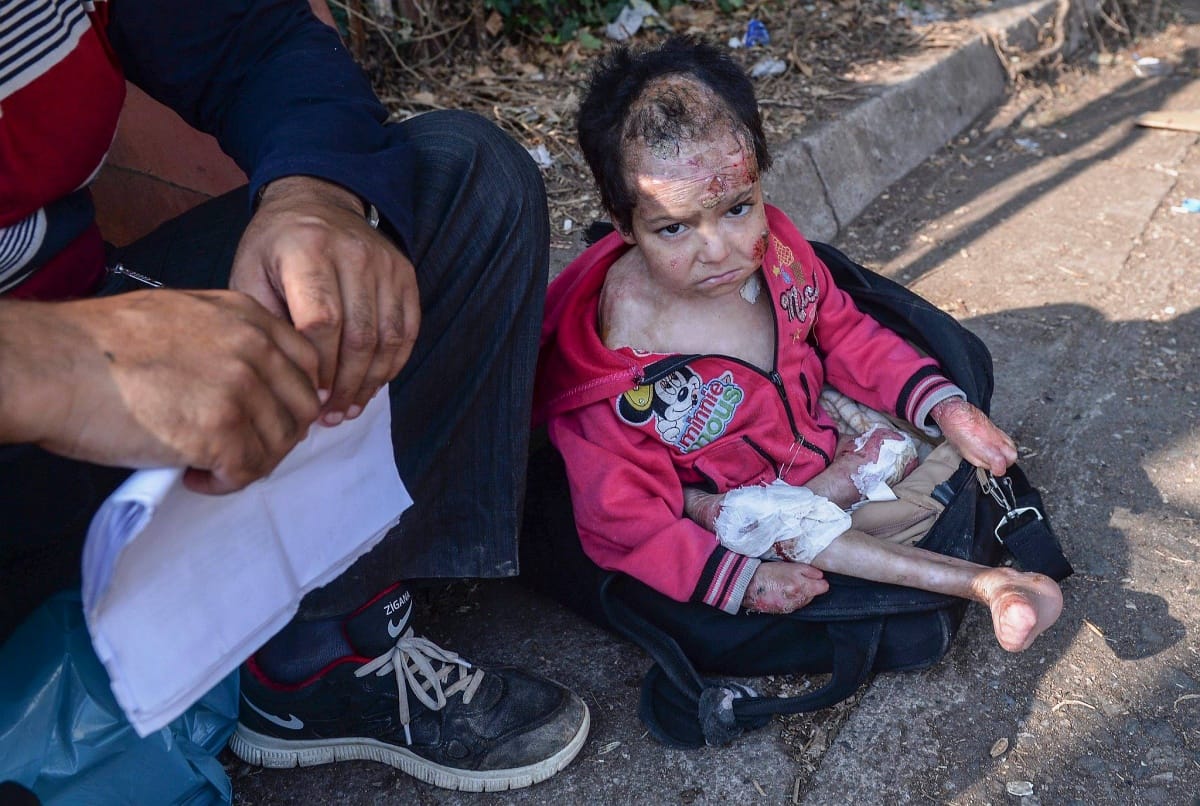 Nem bombától sérült meg a Budapesten ápolt szír migráns kisfiú