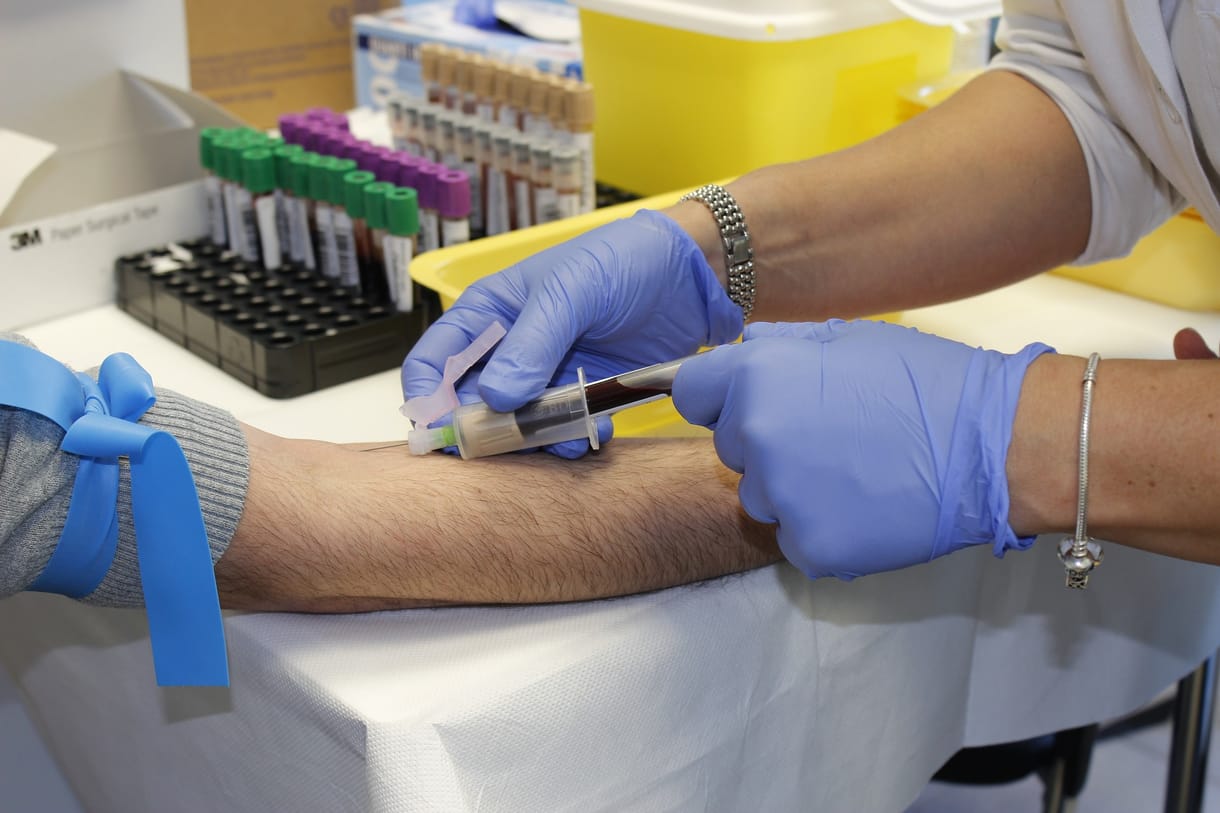 Vérből deríti ki egy új teszt, Alzheimer-kórban szenved-e valaki, és mennyire súlyos a helyzet