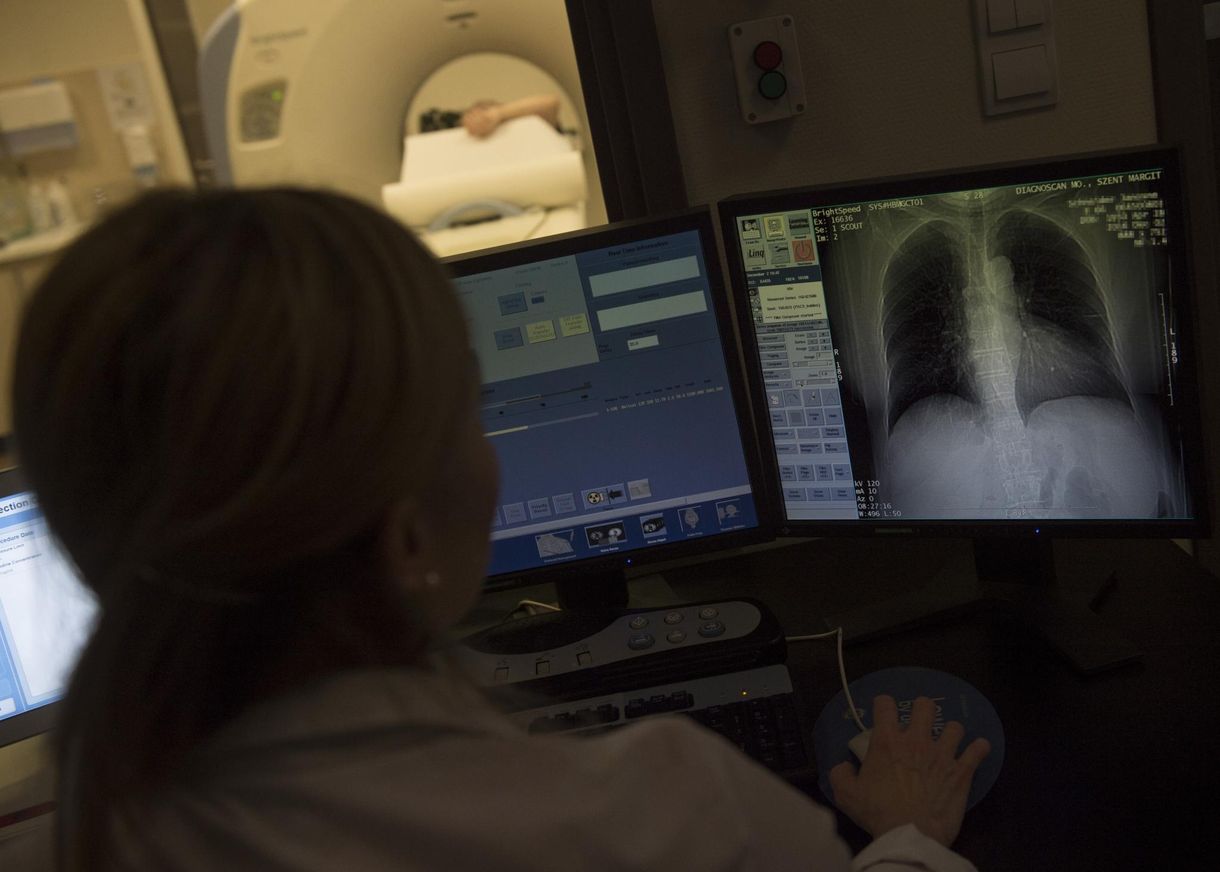 WHO: évek óta először nőtt a tbc-s megbetegedések száma