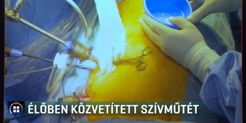Újfajta eljárással segíthetnek a jövőben a szívritmuszavaros betegeken magyar orvosok