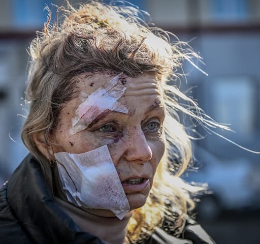 A háború első napjának emblematikus képe Olena Kurilo 52 éves tanárnőről készült, akinek a kelet-ukrajnai Csuhujivben lévő házát bombatalálat érte. 