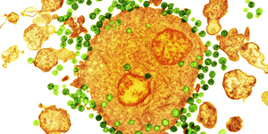 Egy mRNS-módszer csalogathatja elő a szervezetben rejtőző HIV-vírust, hogy aztán végleg elpusztítható legyen