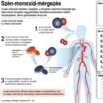 Már öt perc után ölhet a szén-monoxid