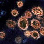 Koronavírus: 36 újabb fertőzött, elhunyt egy idős férfi