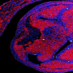 Ijesztő dologra jöttek rá biológusok: olyan szívszövetekbe is eljuthatnak a nanoműanyagok, ahová erek nem is vezetnek