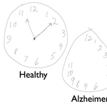 Csak rajzolni kell a képernyőre, és kiderítik, hogy érinti-e a Parkinson vagy az Alzheimer