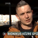 Bionikus kézre gyűjt a szakács, akit elgázolt a villamos Budapesten