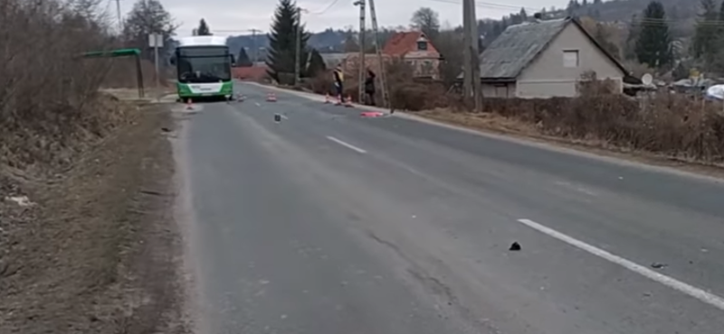 Busz takarásából lépett ki egy kislány Miskolcon, elütötte egy autó