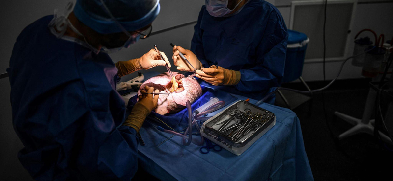 41 ezres a műtéti várólista, a NEAK főigazgatója sem érti, miért