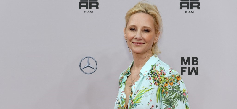 Anne Heche lélegeztetőgépre került, kómában van, és kritikus az állapota