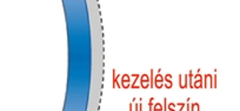 Lézeres látásjavítás: 1 dioptria 2 másodperc alatt! (x)