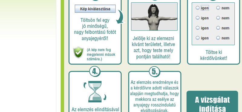 Gyanús az egyik anyajegye? Itt az online melanomaszűrés