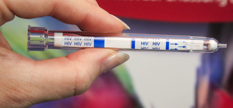 Hárompercenként megfertőz egy tizenéves lányt a HIV-vírus