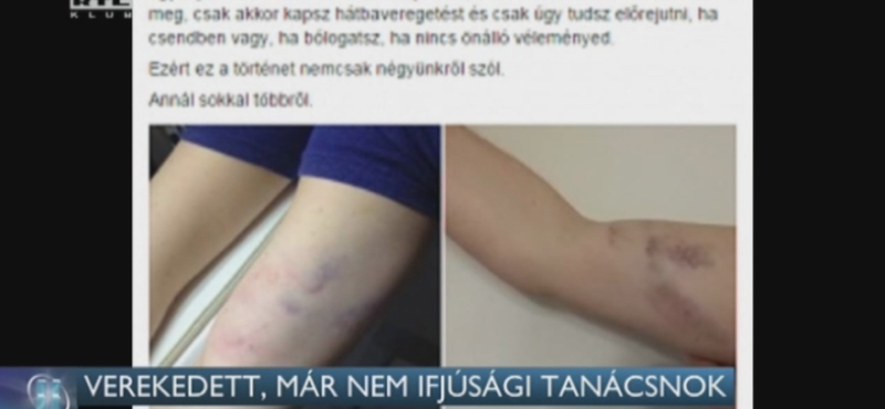 Nyomoznak a Fidelitas wellness disznóvágásán kitört verekedés ügyében