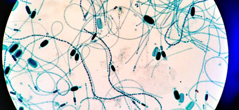 Cianobaktérium miatt tiltották be a fürdőzést a Holt-Tiszánál