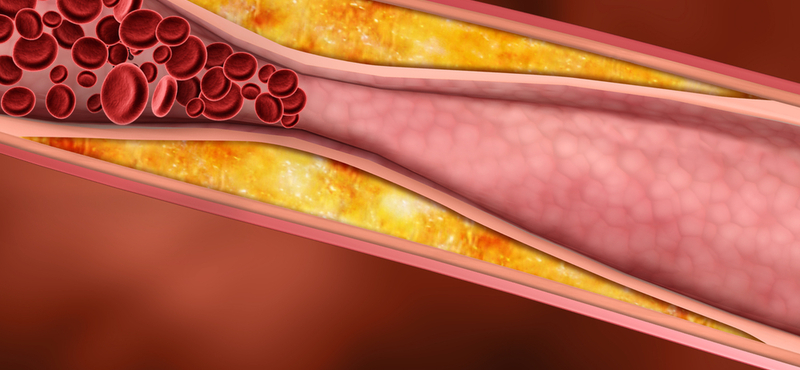 Most akkor jó a koleszterin vagy nem? - tények és tévhitek