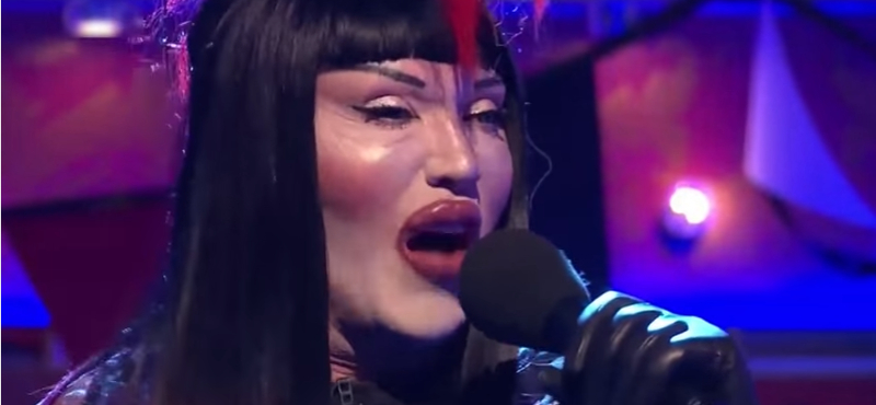 Meghalt Pete Burns, az agyonműtött arcú énekes