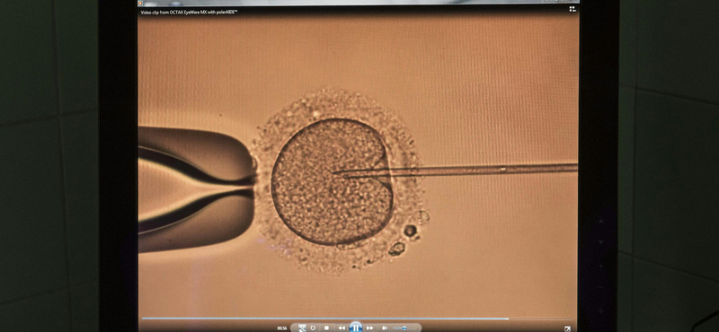 Új tervezet az állami lombikkezelésekről: 36 év alatt csak egy embriót ültetnek be, 45 év marad a korhatár, és kijelölték a szakambulanciákat